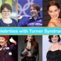 20 Celebrities with Turner Syndrome: Stories of Resilience