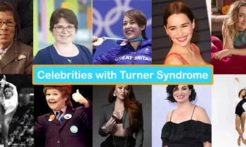 celebrities with turner syndrome