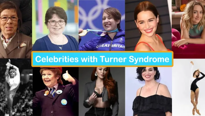 20 Celebrities with Turner Syndrome: Stories of Resilience